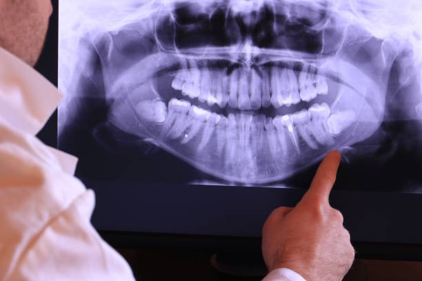 Best Emergency Denture Repair in Orange City, FL